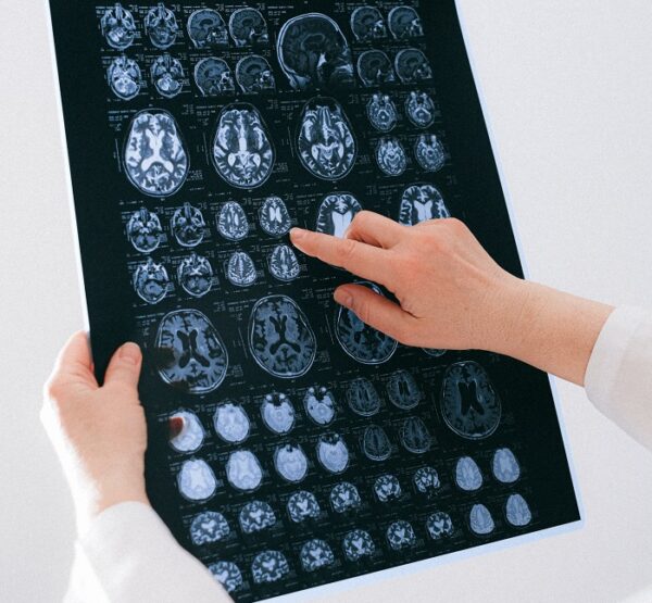 brain